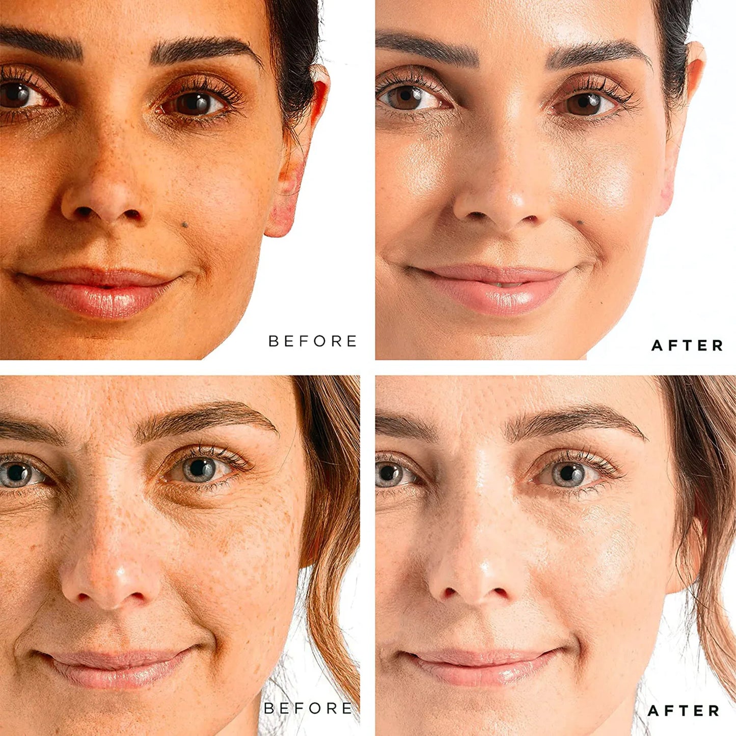 AILKE Whitening Dark Spot Remove Facial Skin Care Cream With Collagen Anti- Freckles Wrinkle Repair Women Premium Face Product